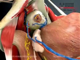 Радикальная простатэктомия (Radical Prostatectomy)